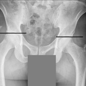 LLX-ray1 Spinal X-Rays For TMJ Pain Relief Near Me in Houston, TX.